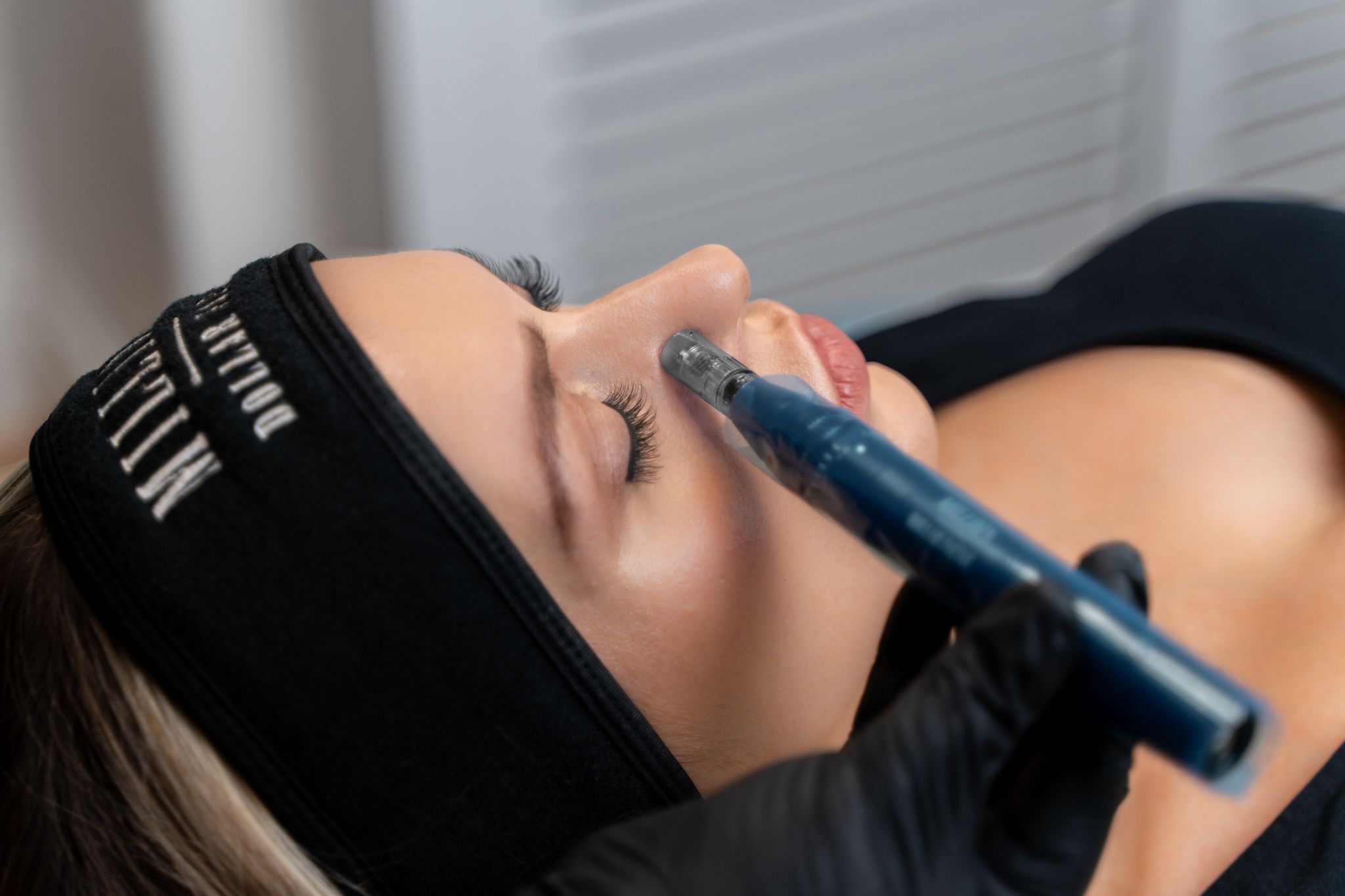 Million Dollar Microneedling by NS Skin and Beauty